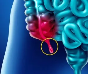 Có phải ruột thừa là phần thừa của cơ thể?