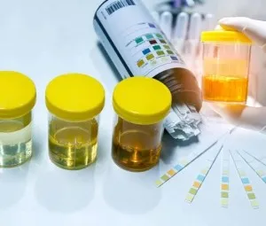 Nước tiểu được hình thành như thế nào?