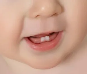 Răng có phải là một "mẫu xương" đặc không?