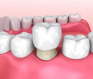 Vì sao răng có hình dạng khác nhau?