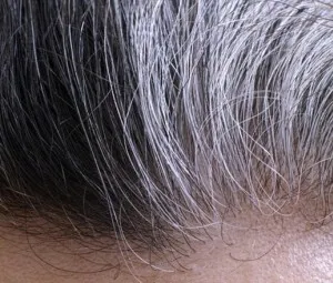 Vì sao tóc của một số thanh, thiếu niên bạc sớm?