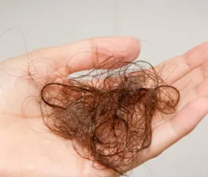 Vì sao tóc thường rụng?