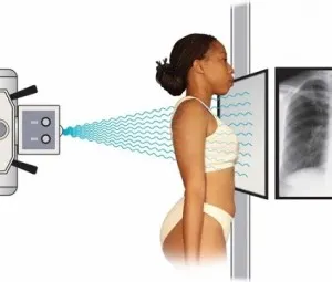 Tại sao dùng tia X có thể chẩn đoán được bệnh trong cơ thể người?