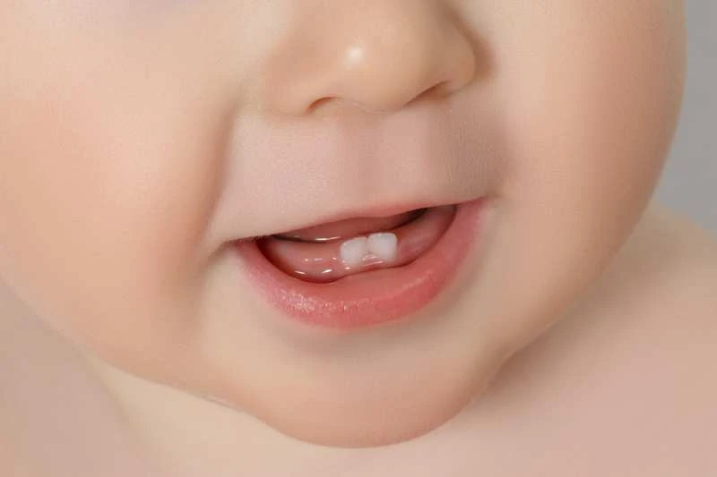 Răng có phải là một