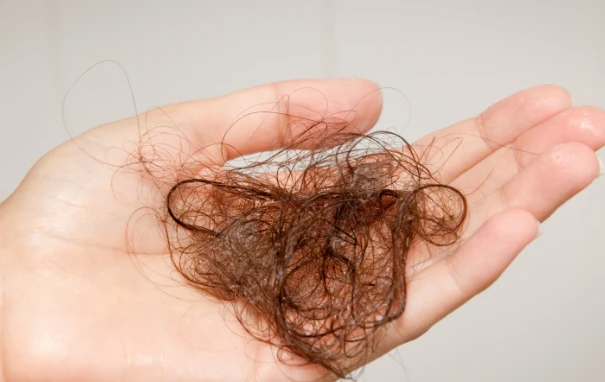 Vì sao tóc thường rụng? – Kho truyện cổ tích